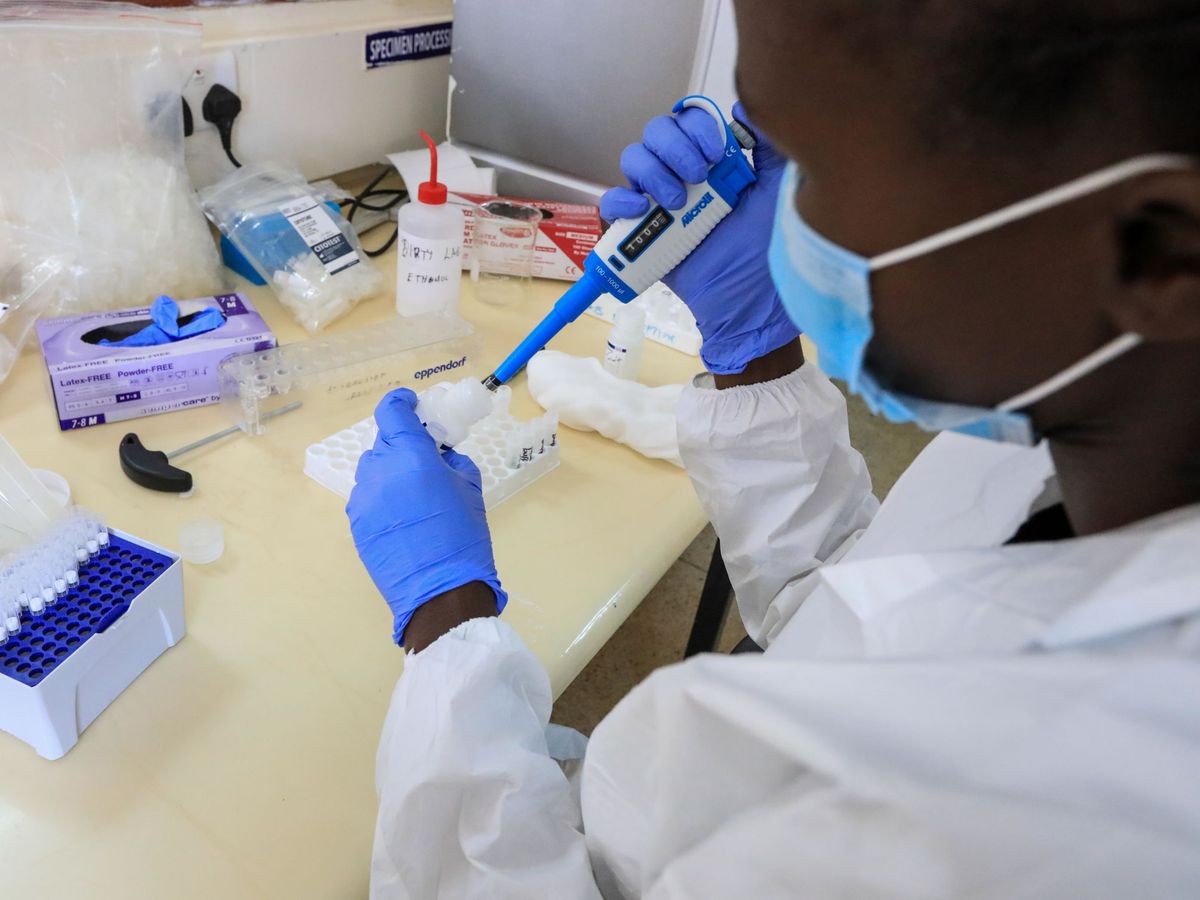 Foto: El Instituto Pasteur desarrolla el primer test para ver nuestra inmunidad al coronavirus. (Reuters)