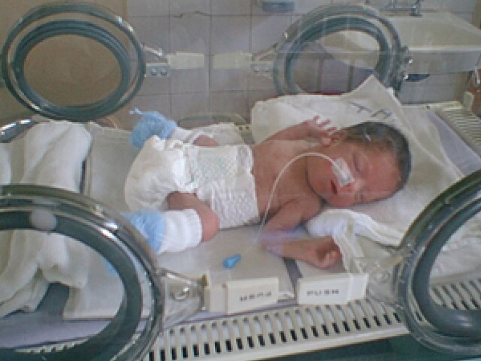 Foto: Alertan del peligro de la ventilación artificial en bebés prematuros