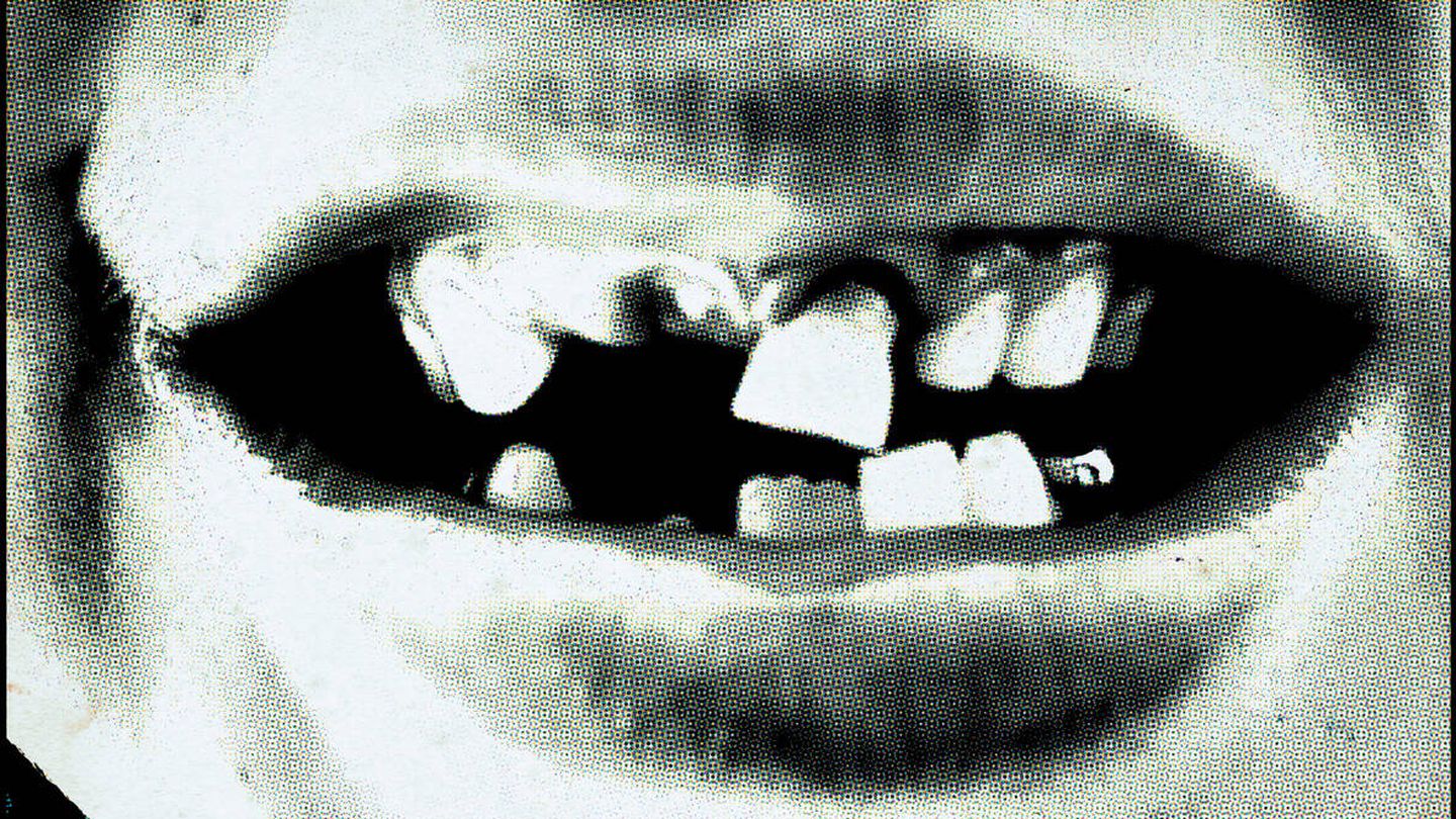Boca de un niño con los dientes caídos. Fuente: iStock.