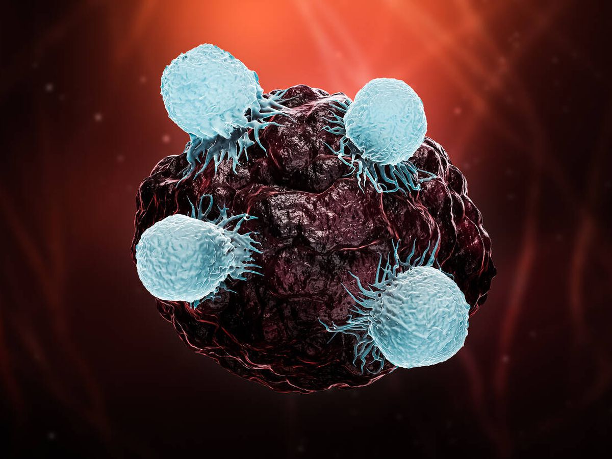 Foto: Representación de células con linfoma. (iStock)