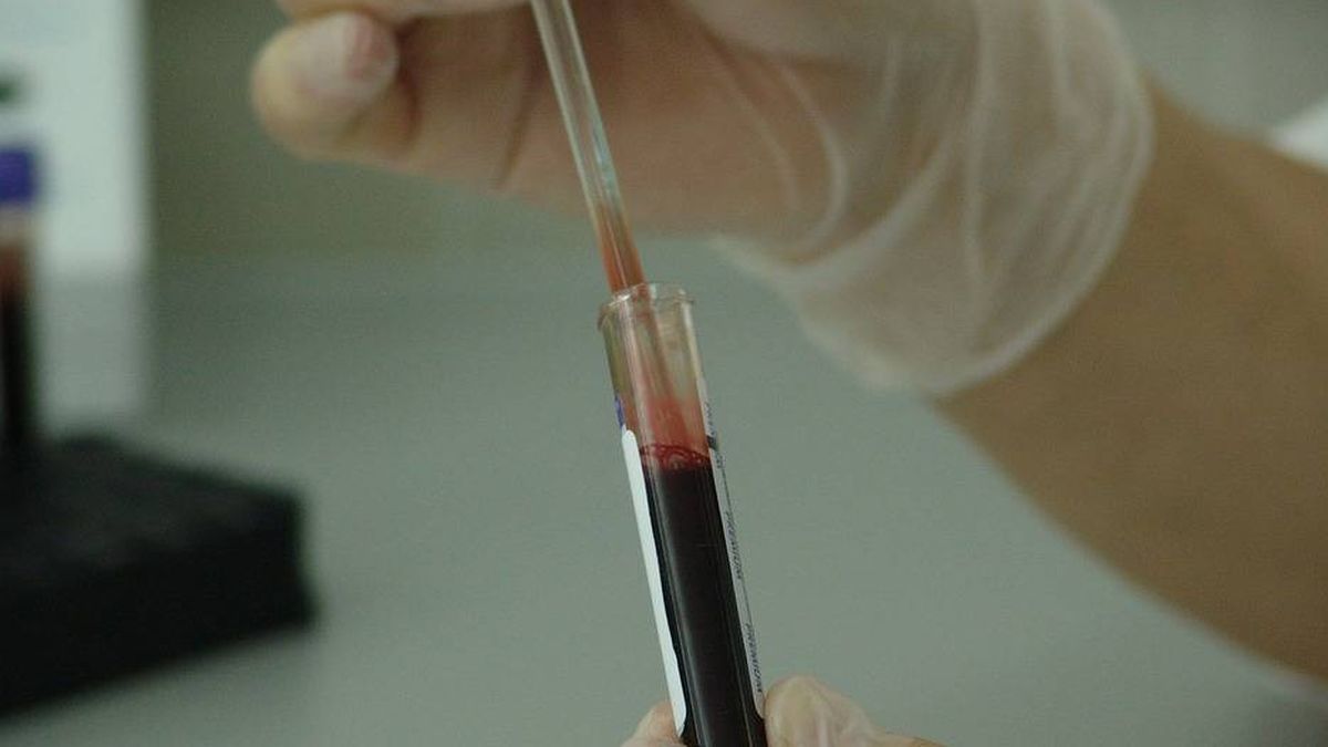 Desarrollan un método "10 veces más sensible" para detectar el cáncer en la sangre 