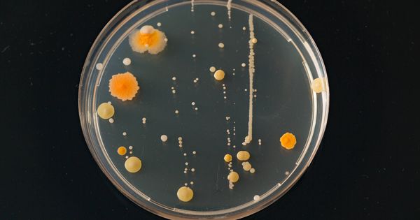 Foto: Miles de bacterias en una placa de Petri. (iStock)