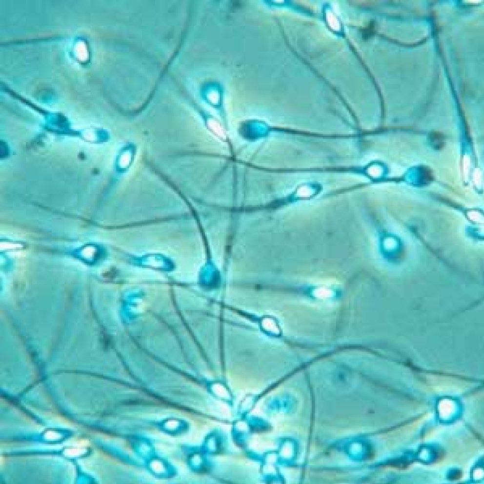 Foto: Obtener los espermatozoides del testículo y no del semen aumenta la fertilidad
