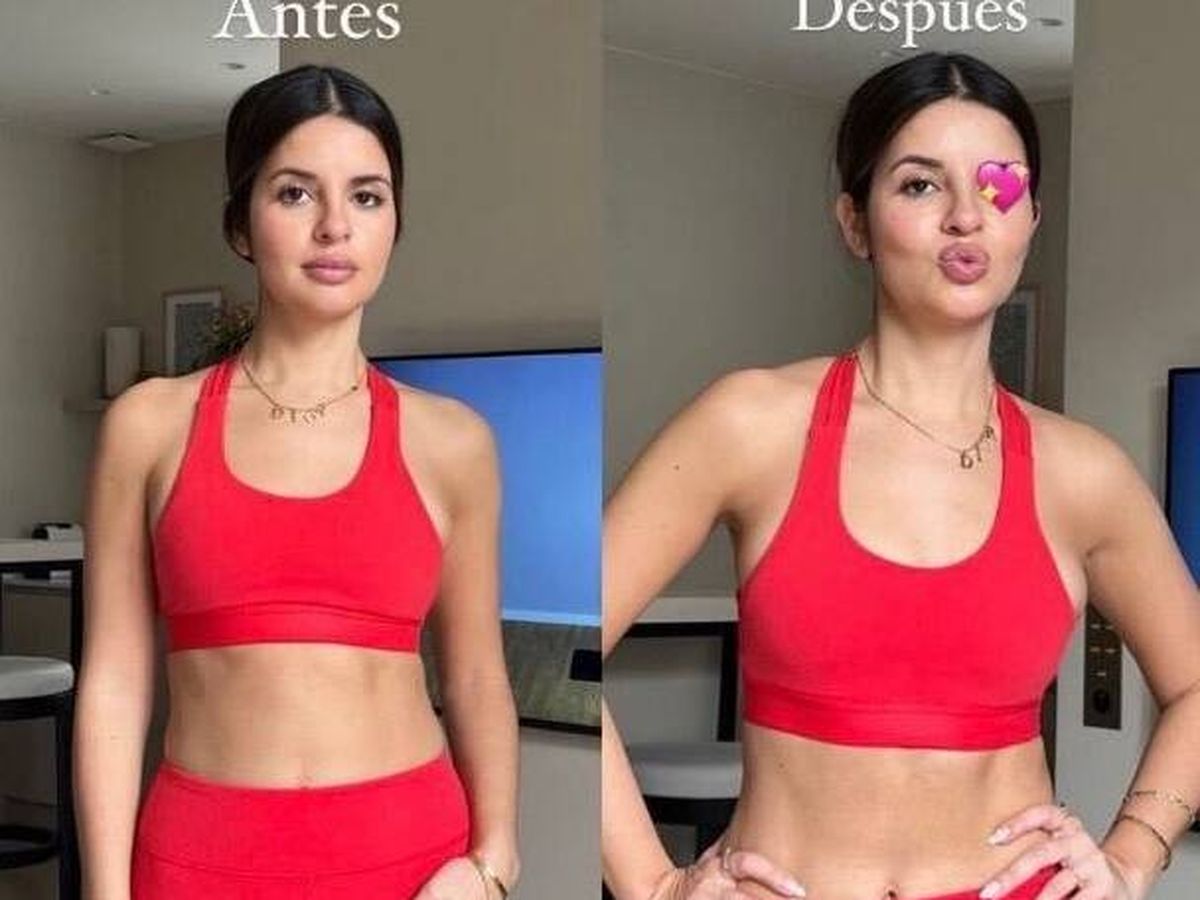 Foto: "He entrenado 20 minutos y mirad qué diferencia" Una 'influencer' enseña el antes y después de su abdomen y despierta la polémica en redes (Instagram/@nataliaosona/X/@infarruco)
