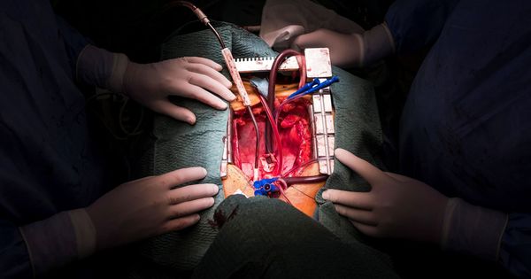 Foto: Operación de transplante de corazón