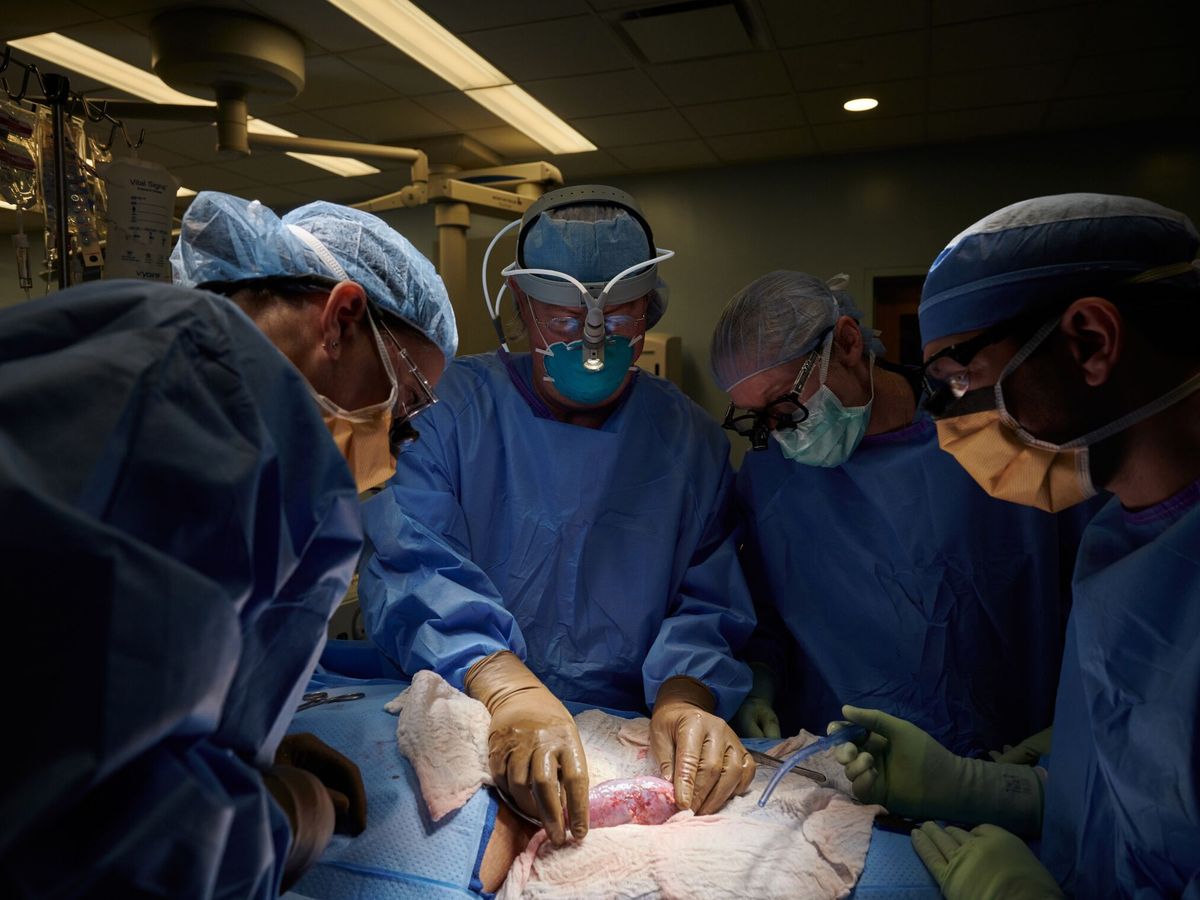Foto: Trasplante de un riñón de cerdo a humano en Nueva York en 2021. (EFE / NYU Langone Health Joe Carrotta)