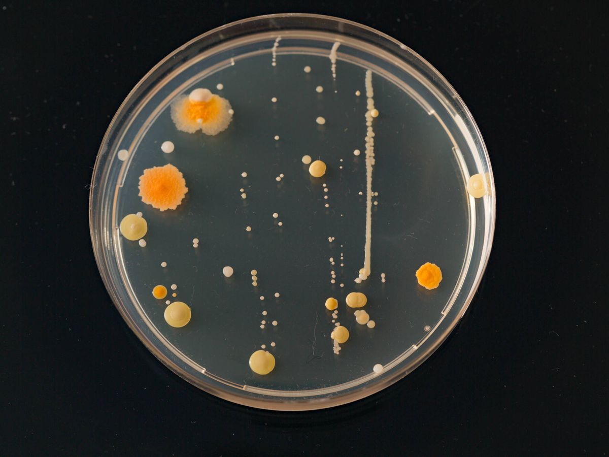 Foto: Miles de bacterias en una placa de petri. (iStock)