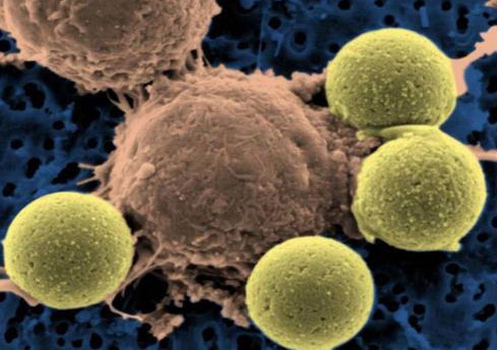 Foto: La nanopartícula denominada Trial es capaz de atraer y matar las células cancerígenas. (Corbis)