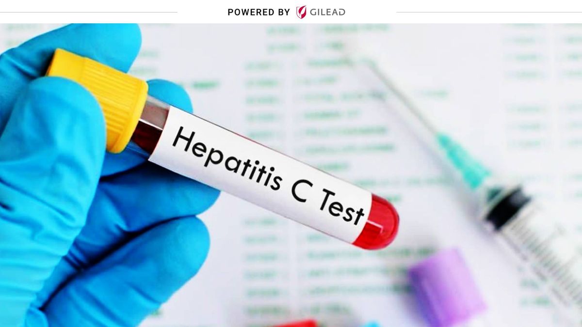 ¿Cómo ha afectado la pandemia del coronavirus a los enfermos de hepatitis C?