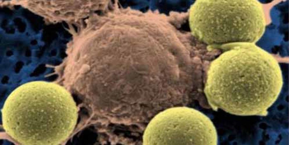 Foto: Descubren dos genes clave en la leucemia infantil más común