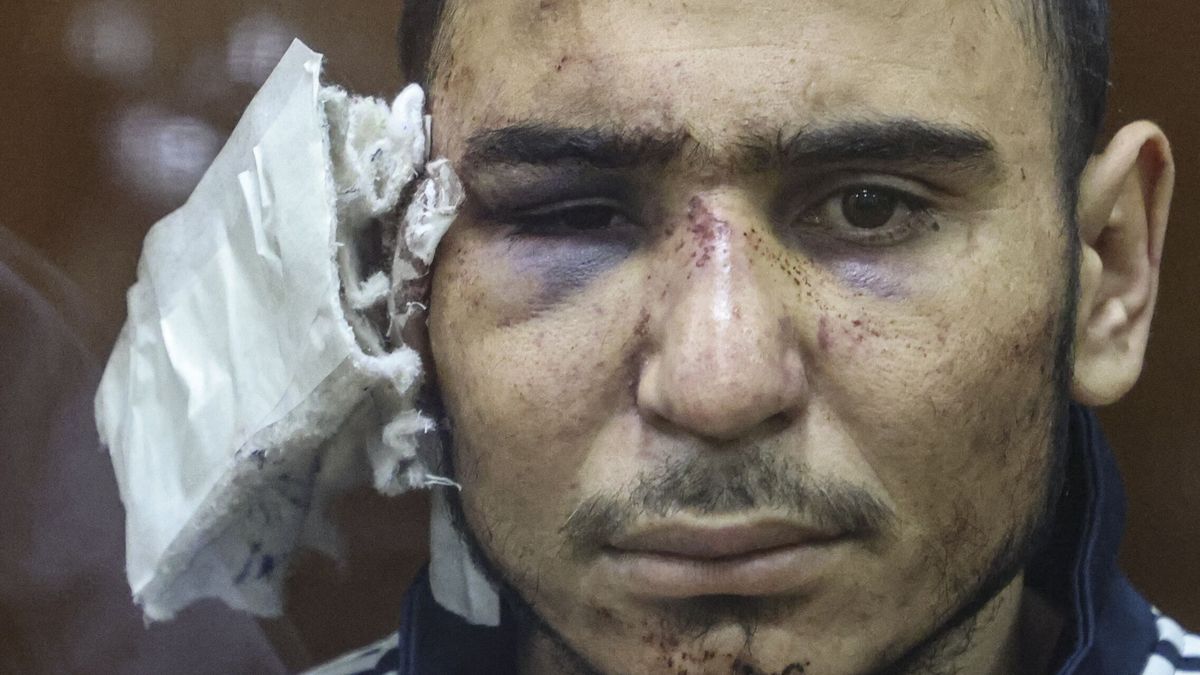 Las sorprendentes imágenes de los terroristas del atentado en Rusia: sin oreja, en sillas de ruedas y con el rostro desfigurado