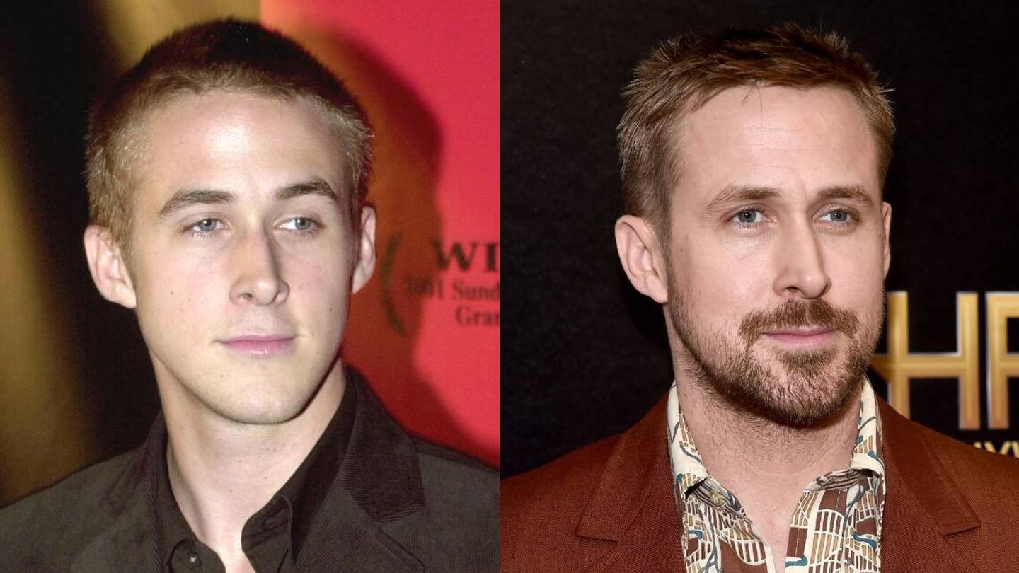 Ryan Gosling, antes y después de la rinoplastia. (Getty)