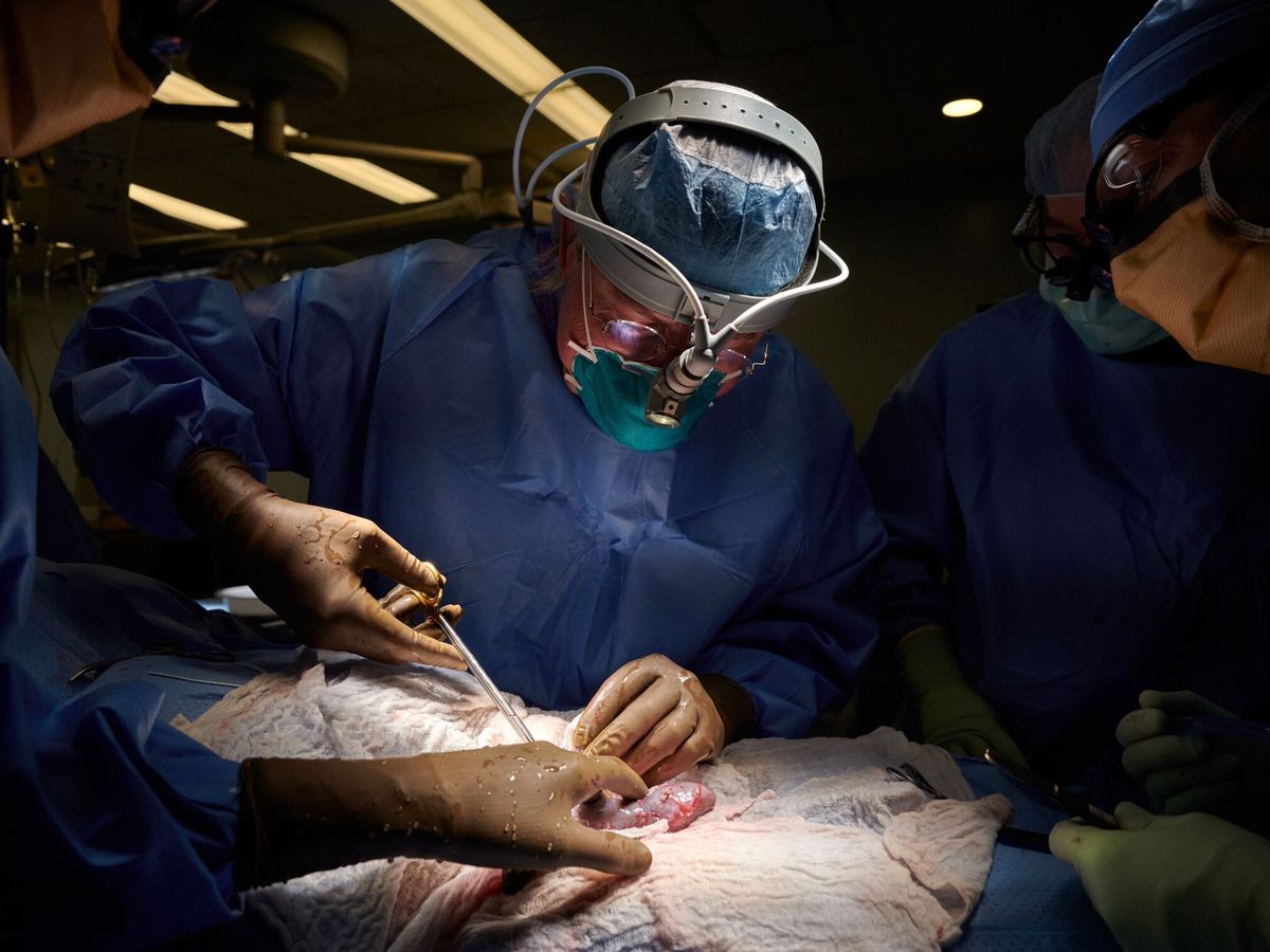 Foto: Médicos consiguen trasplantar un riñón de cerdo a un humano. (EFE/NYU Langone Health/Joe Carrotta) 
