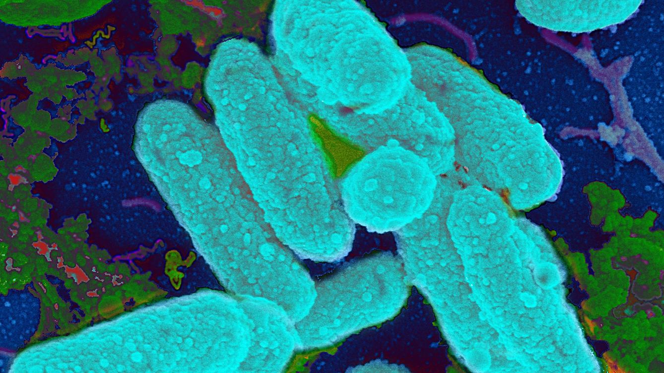 Заболевание бактериальной природы. Синегнойная бактерия. Бактерии Haemophilus influenzae. Pseudomonas aeruginosa пневмония. Псевдомонада.