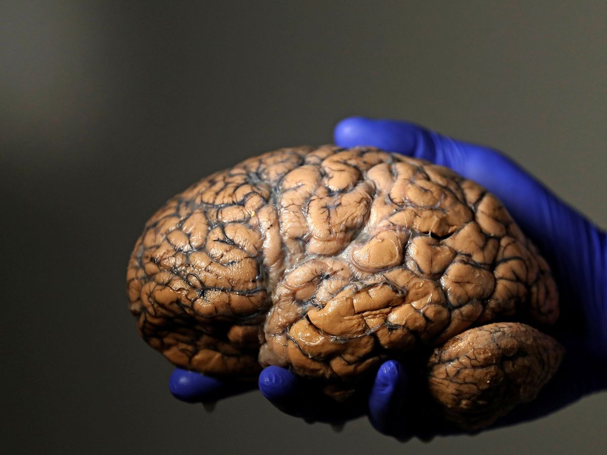 Foto: Imagen de archivo de un cerebro. (Reuters)