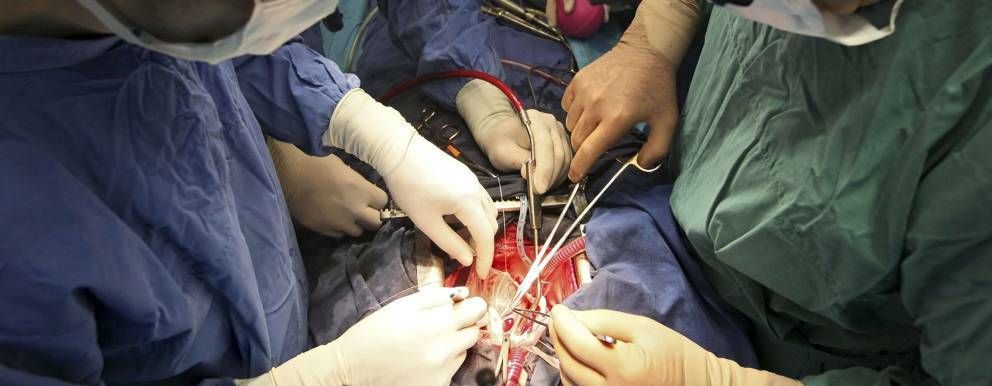 Primera implantación de una válvula en el corazón