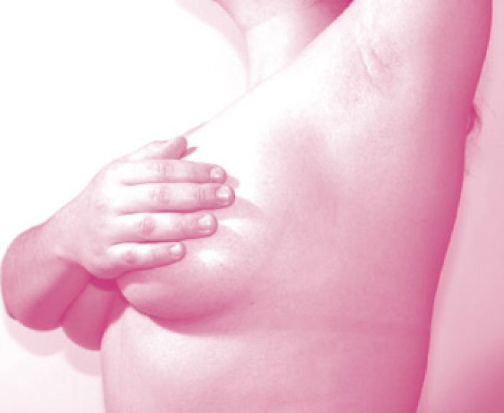 Foto: No hallan relación entre las estatinas y el riesgo de cáncer de pecho