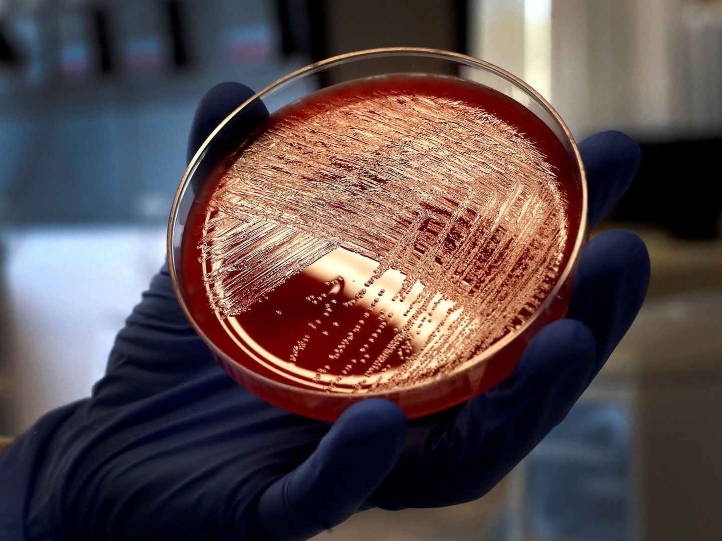 Vista de un cultivo de listeriosis en una placa de Petri, en Laboratorio de Listeriosis del Centro Nacional de Microbiología de Madrid. (EFE)