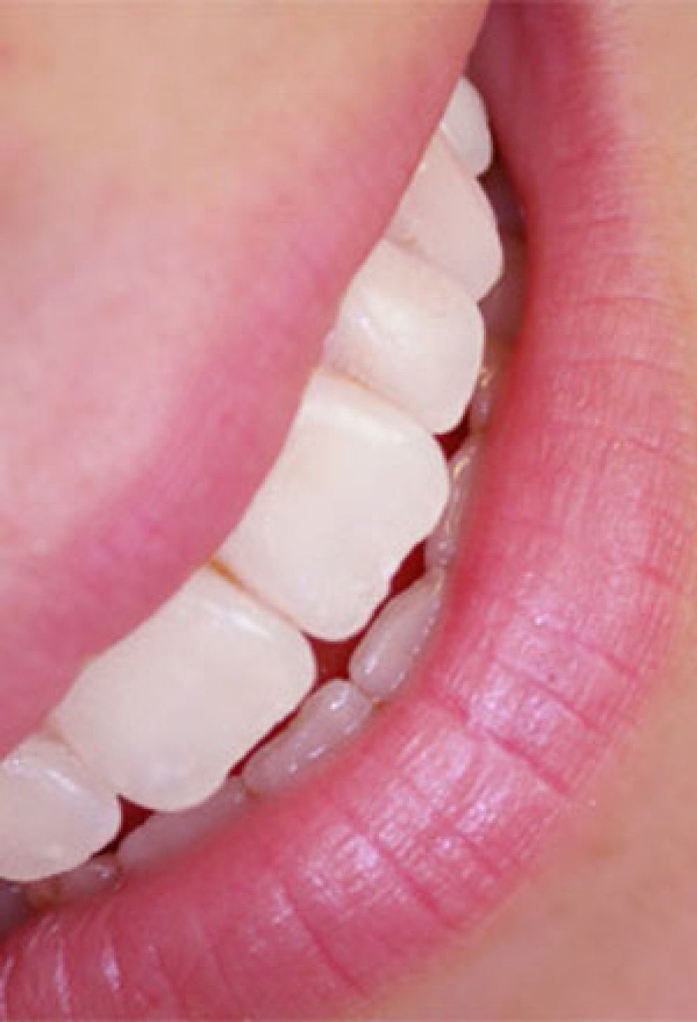 Foto: La revolución del gen que controla el esmalte dental