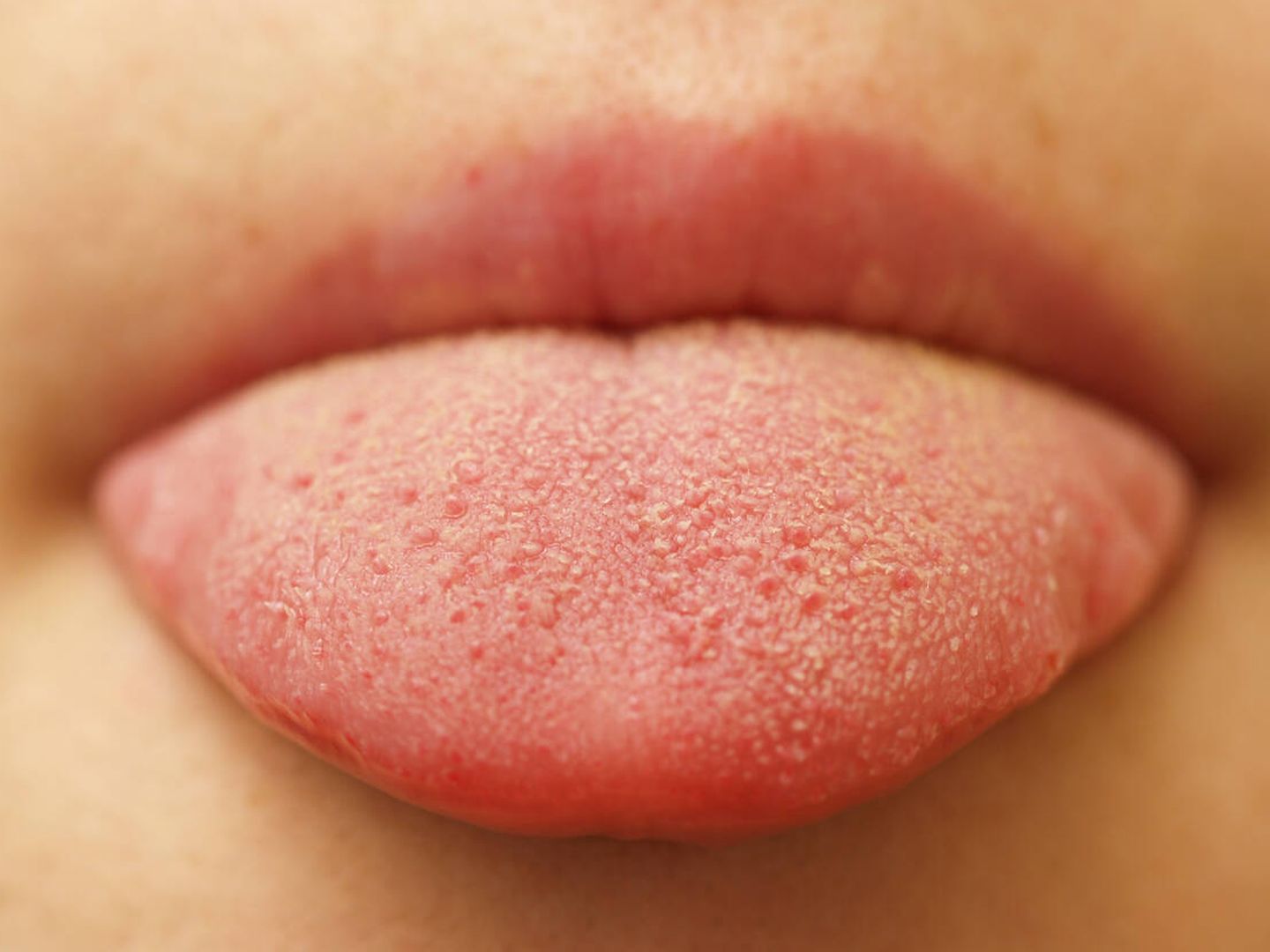 Una investigación analizará papilas gustativas de la lengua para comprobar el efecto de la semaglutida. (iStock)