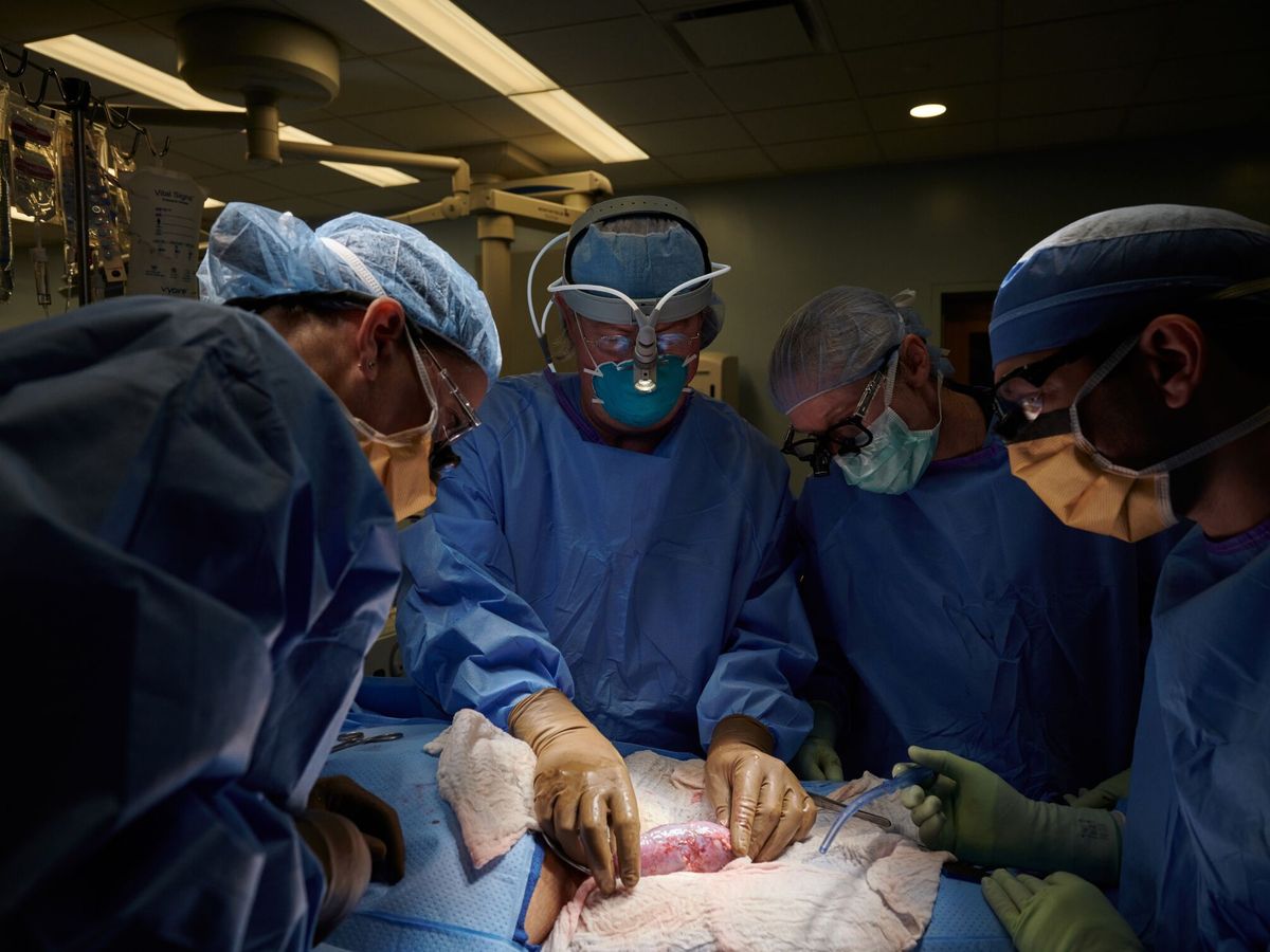 Foto: El primer trasplante de un riñón de cerdo. (Reuters)