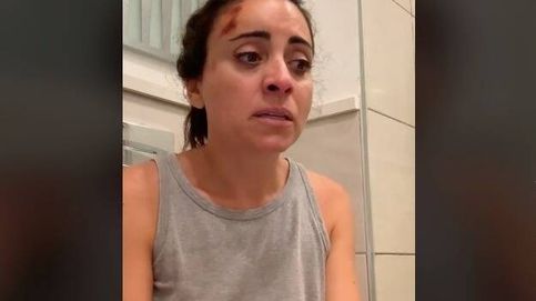 Una española cuenta la angustia que sufrió en un safari en su luna de miel: Me han dado la paliza de mi vida