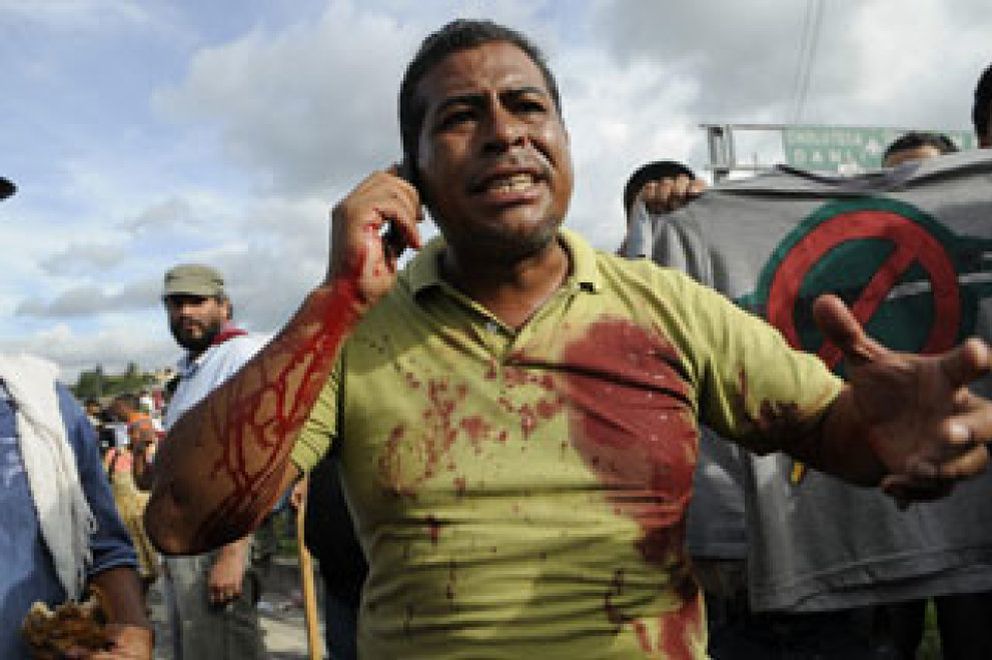 Foto: Un muerto en Tegucigalpa entre los manifestantes pro-Zelaya
