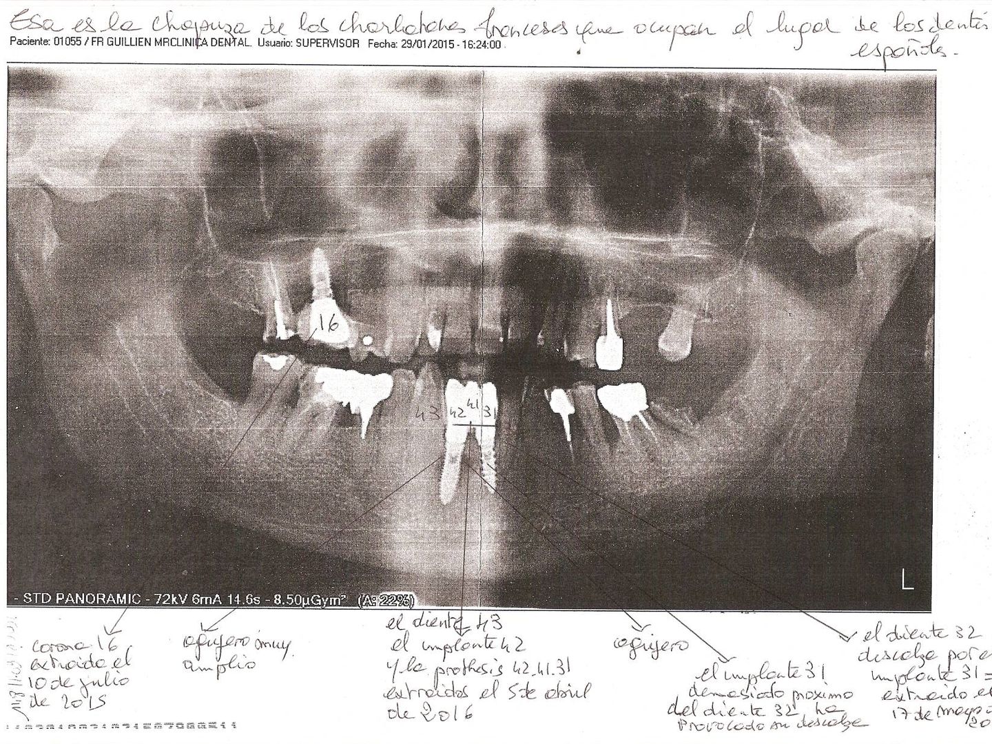 Radiografía panorámica de Michel Guillien tomada en su segunda visita.
