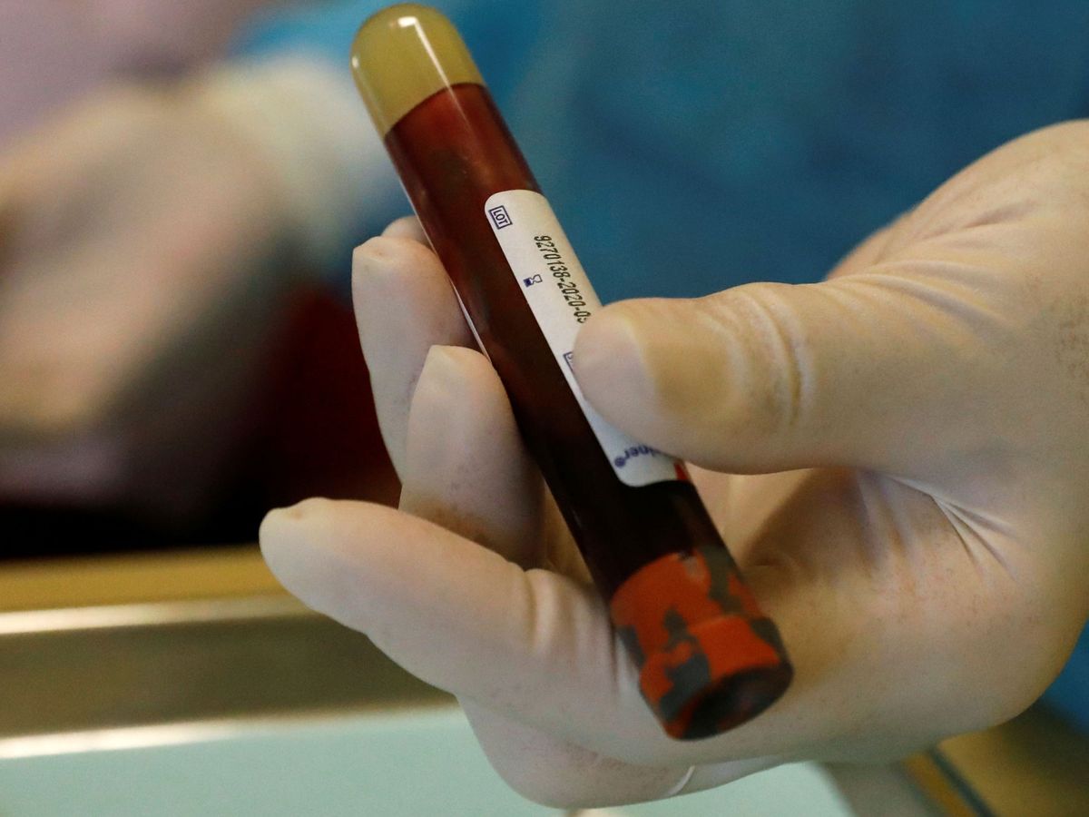 Foto: Los médicos, en contra de los test masivos porque no aportan valor sanitario. (Reuters)