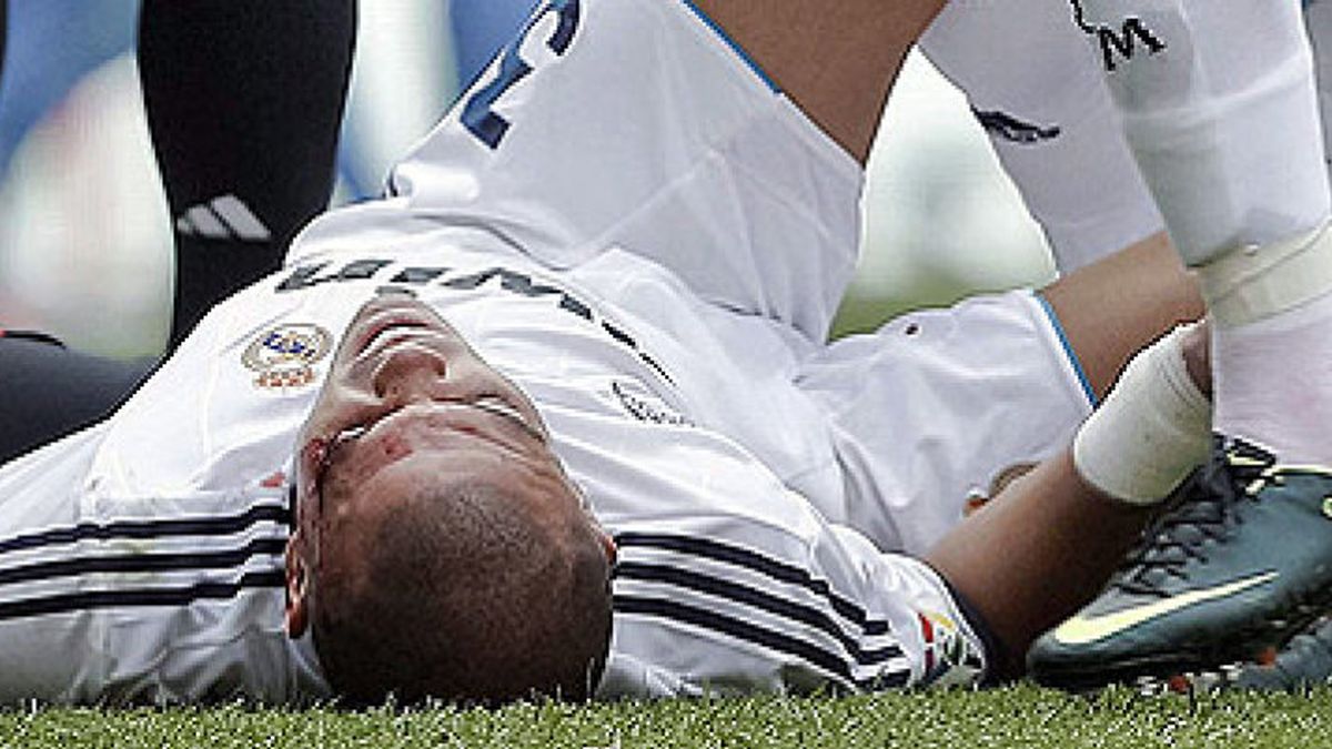 Pepe abandona el hospital y es una baja más que posible ante el Barcelona en la Supercopa