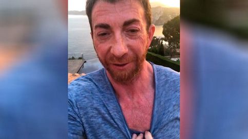 El impactante vídeo de Pablo Motos tras abrasarse al sol en vacaciones