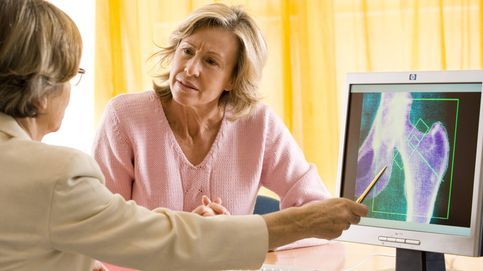 La presión arterial alta puede acelerar el envejecimiento de los huesos