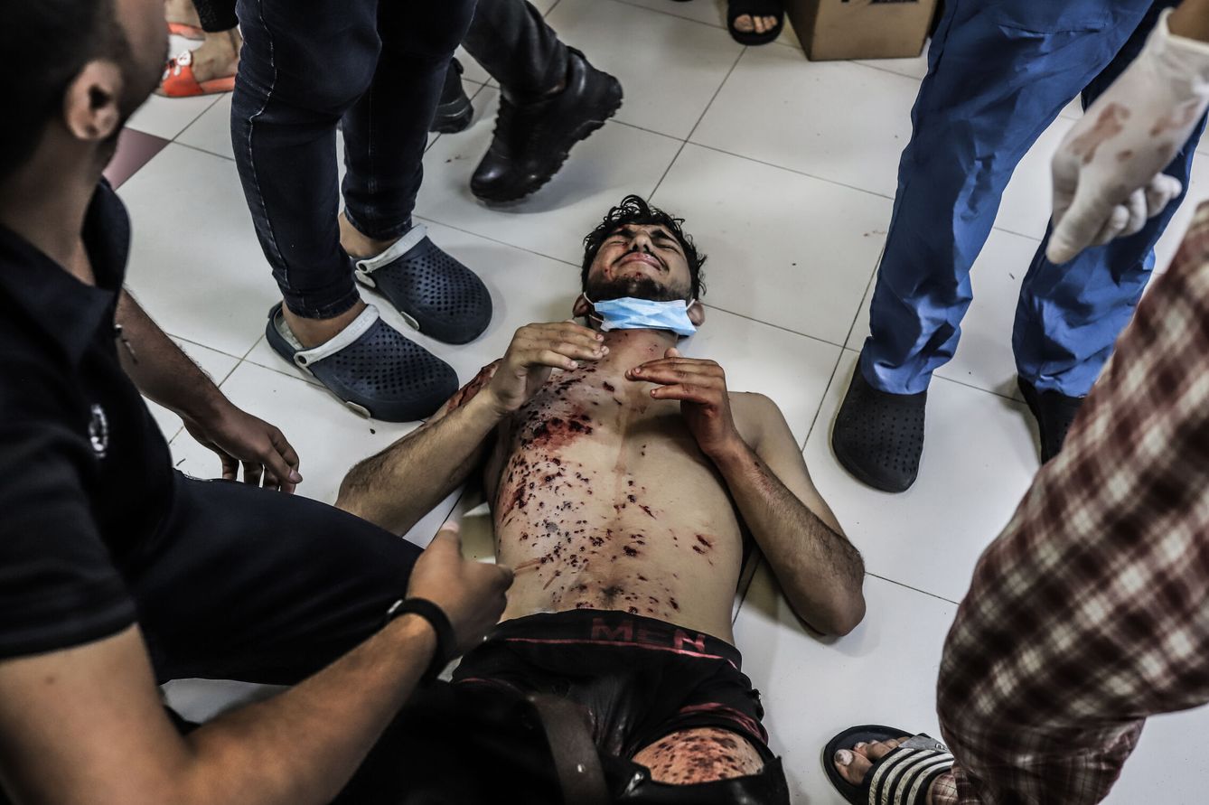 Un palestino, herido, en el suelo del hospital Al Shifa, en Gaza. (DPA/Mohammad Abu Elsebah)