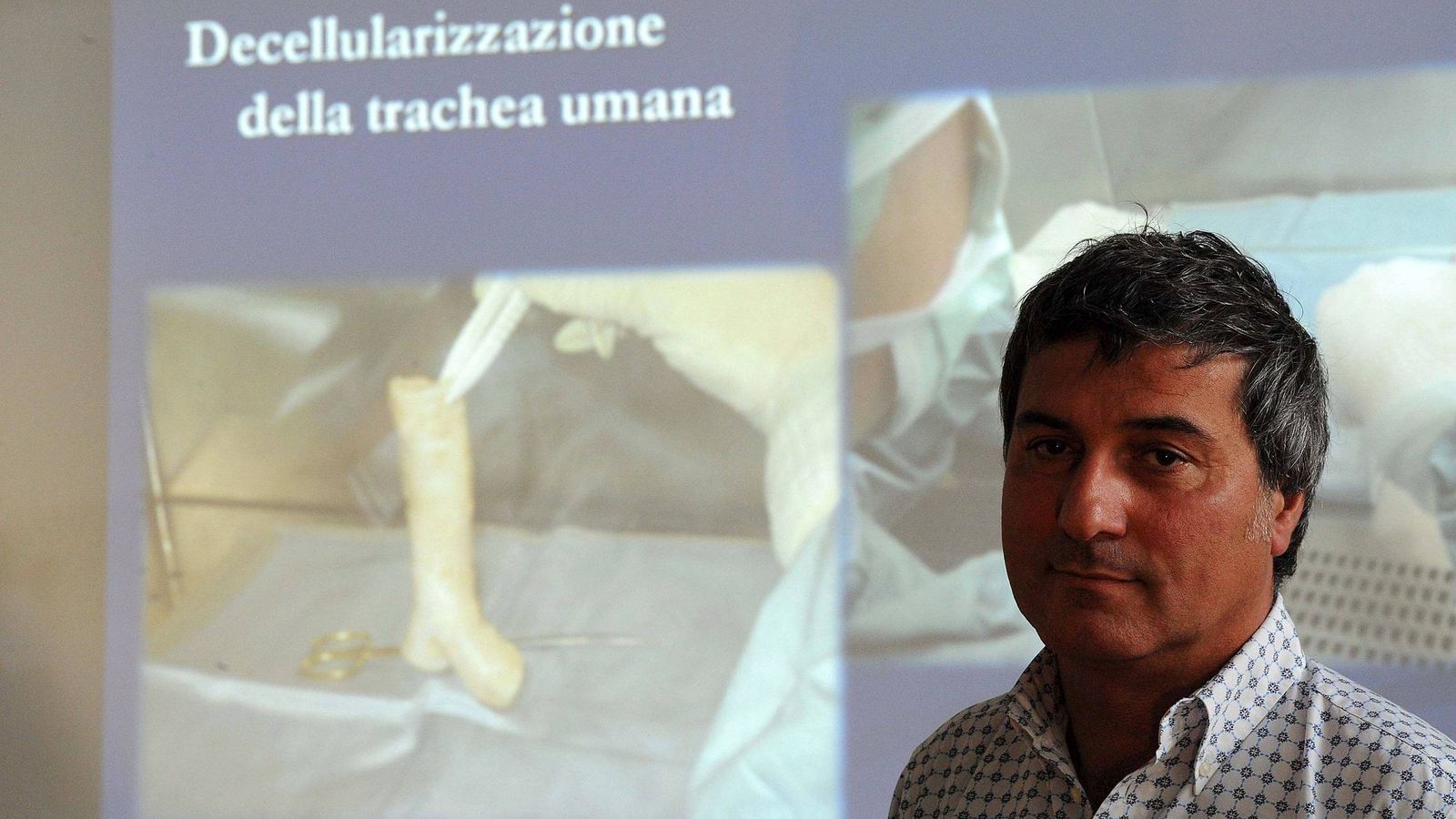 Foto: Paolo Macchiarini, durante una conferencia en Florencia explicando sus operaciones de tráquea. (Efe/Carlo Ferraro)