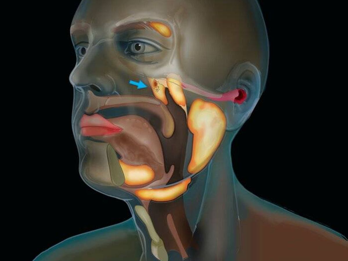 Foto: Señaladas con una flecha azul, las recién descubiertas glándulas salivales. Foto: (The Netherlands Cancer Institute