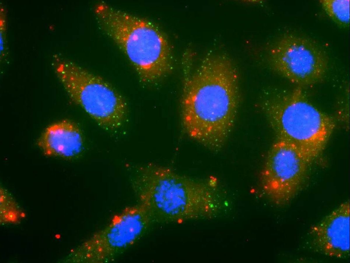 Foto: Nanopartículas de FuOXP-siRNA y células de cáncer de colon de ratón. ('Nature Nanotechnology')