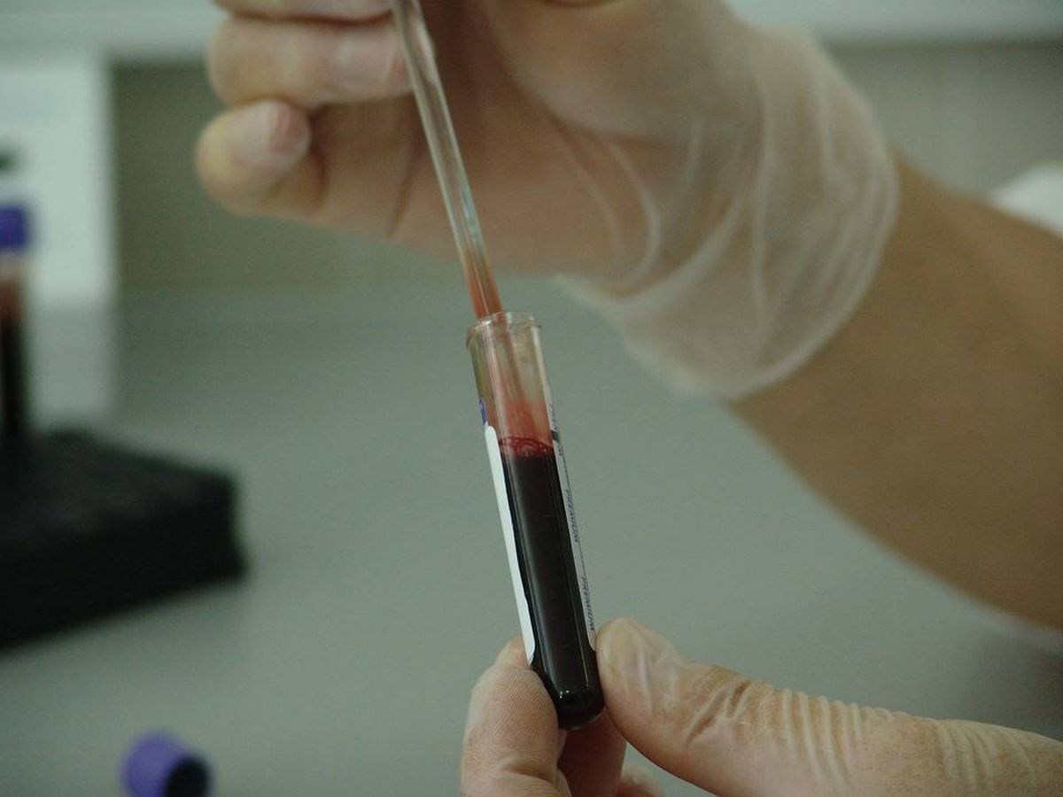 Foto: Un simple análisis de sangre puede ofrecer datos hasta ahora desconocidos (Foto: Pixabay)