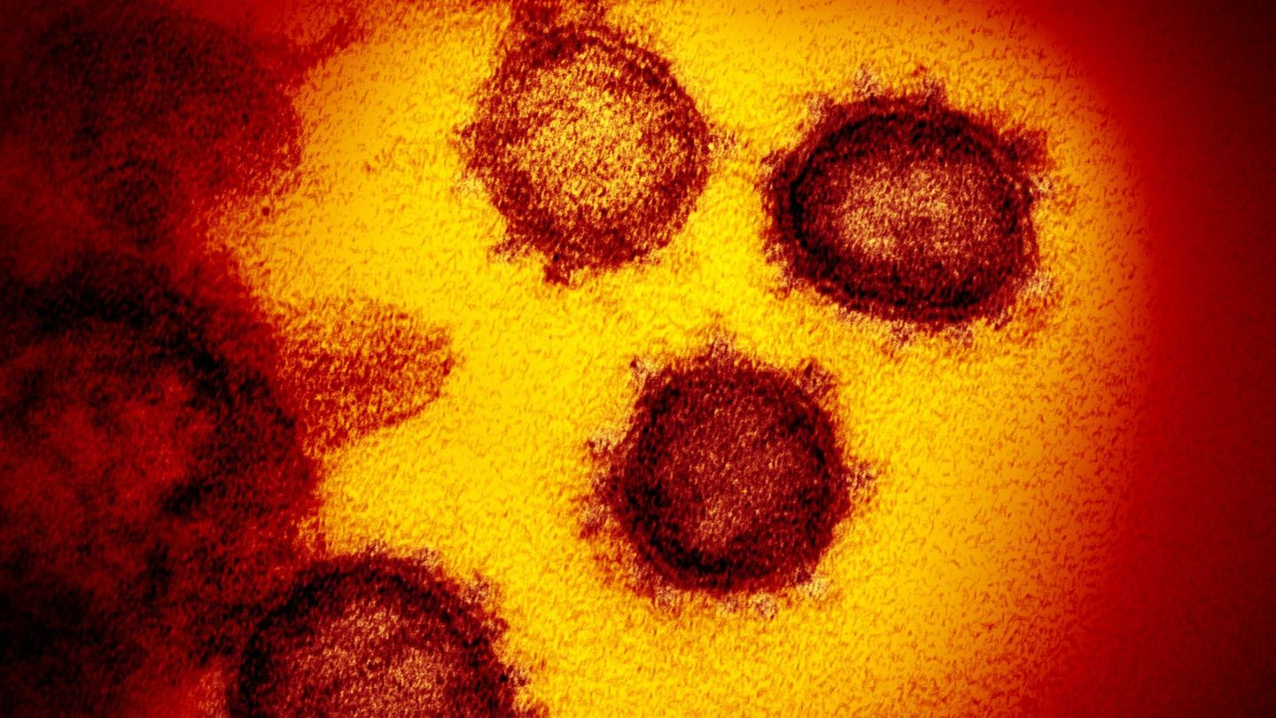 Una imagen al microscopio del nuevo coronavirus. (Reuters)