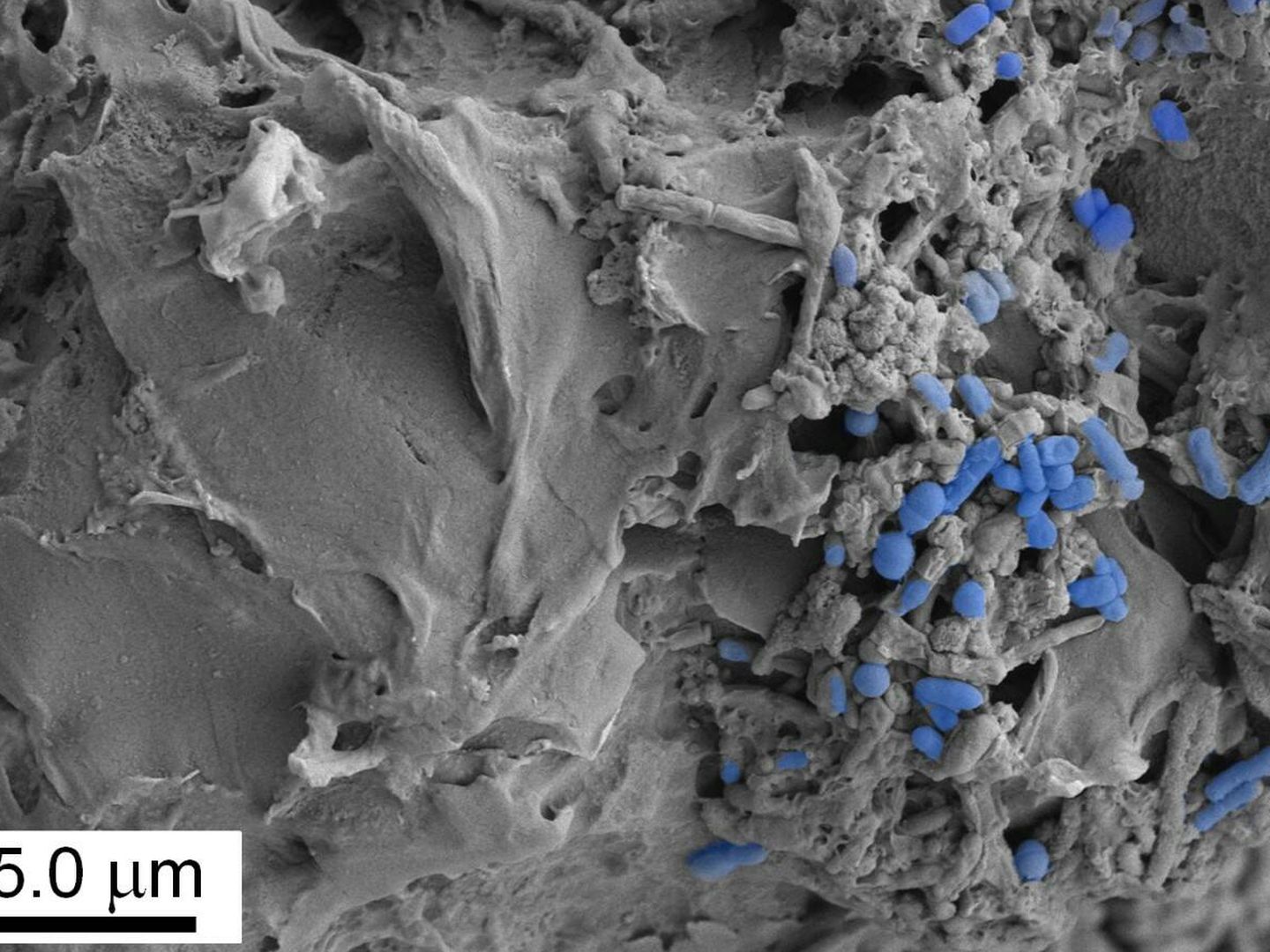 Los microplásticos son partículas de este material de un tamaño de 0,001 a 5 milímetros (EFE).