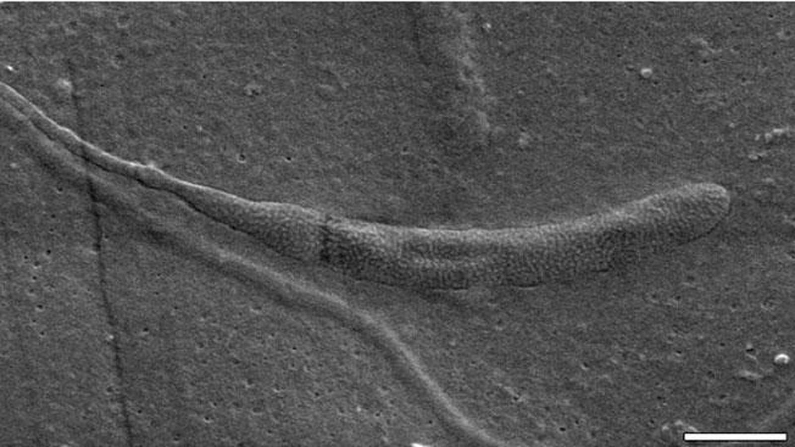 Foto: Un fragmento del esperma encontrado (Swedigh Museum of Natural History)