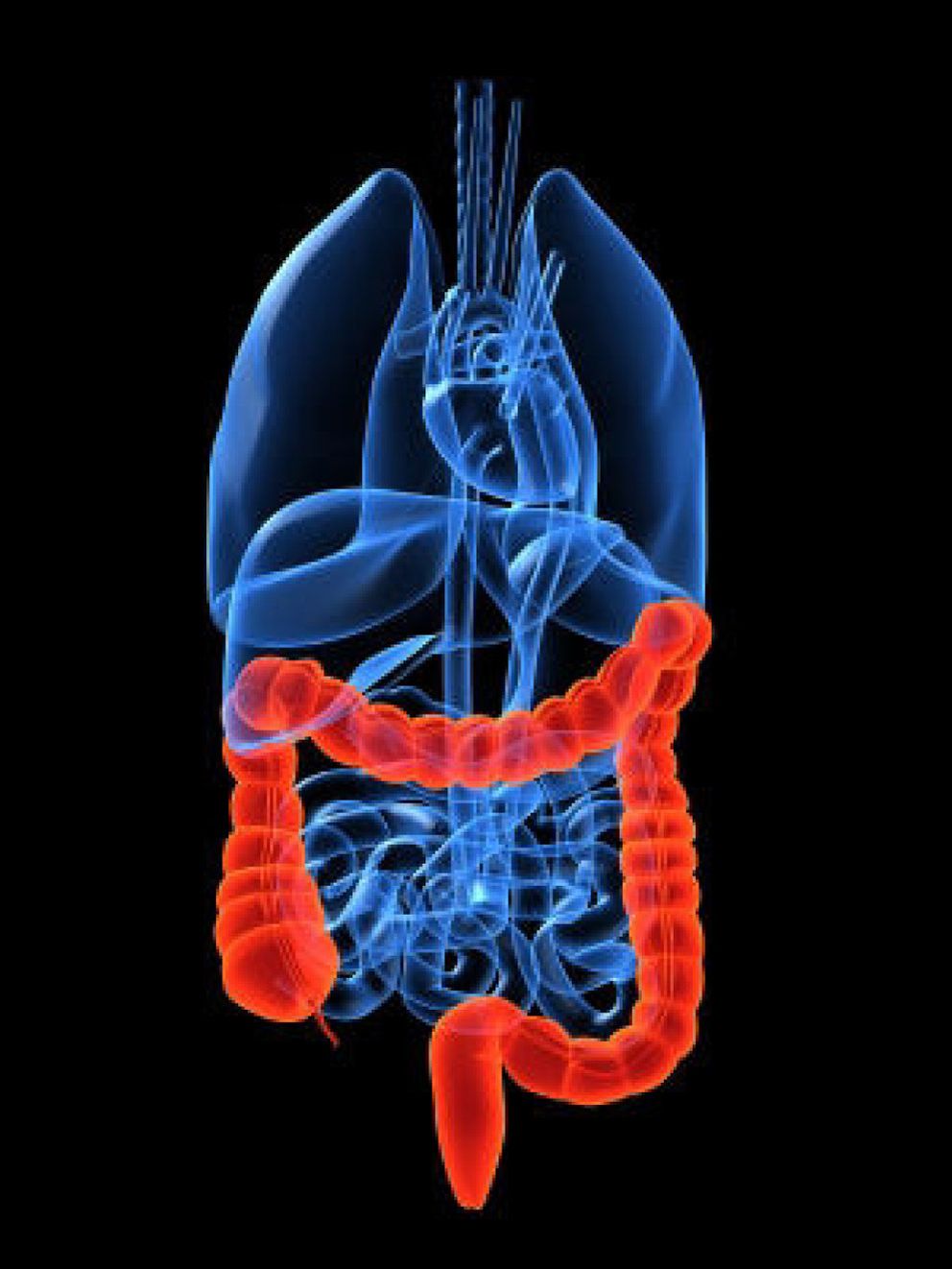 Foto: Cáncer de colon: el más frecuente y el segundo más mortal