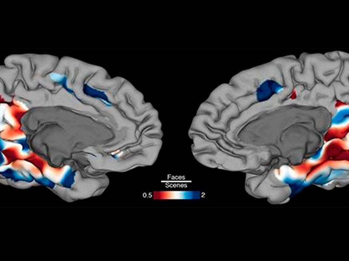 Foto: Imagen de una mapa de la superficie del cerebro que muestra las regiones que se activan preferentemente durante la identificación de la cara (azul) y la escena (rojo). Foto: Oscar Woolnough