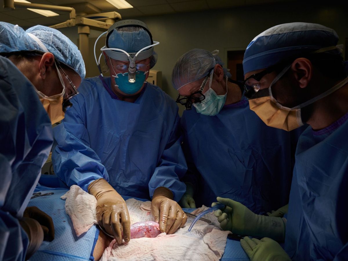 Foto: Médicos del Hospital NYU Langone Health trasplantan un riñón de cerdo a un humano. (EFE/Joe Carrotta)