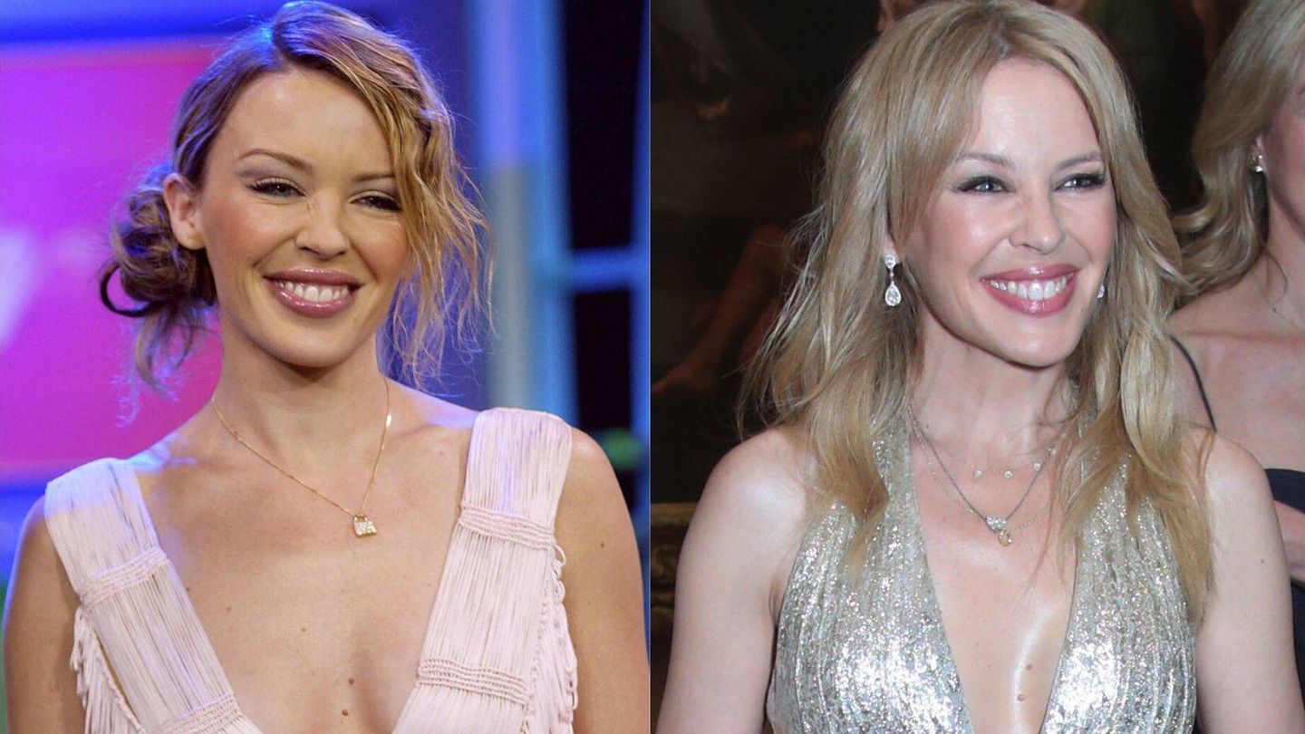 Kylie en 2002 y en 2018. Mismo gesto, misma piel, 16 años de diferencia. (Getty)