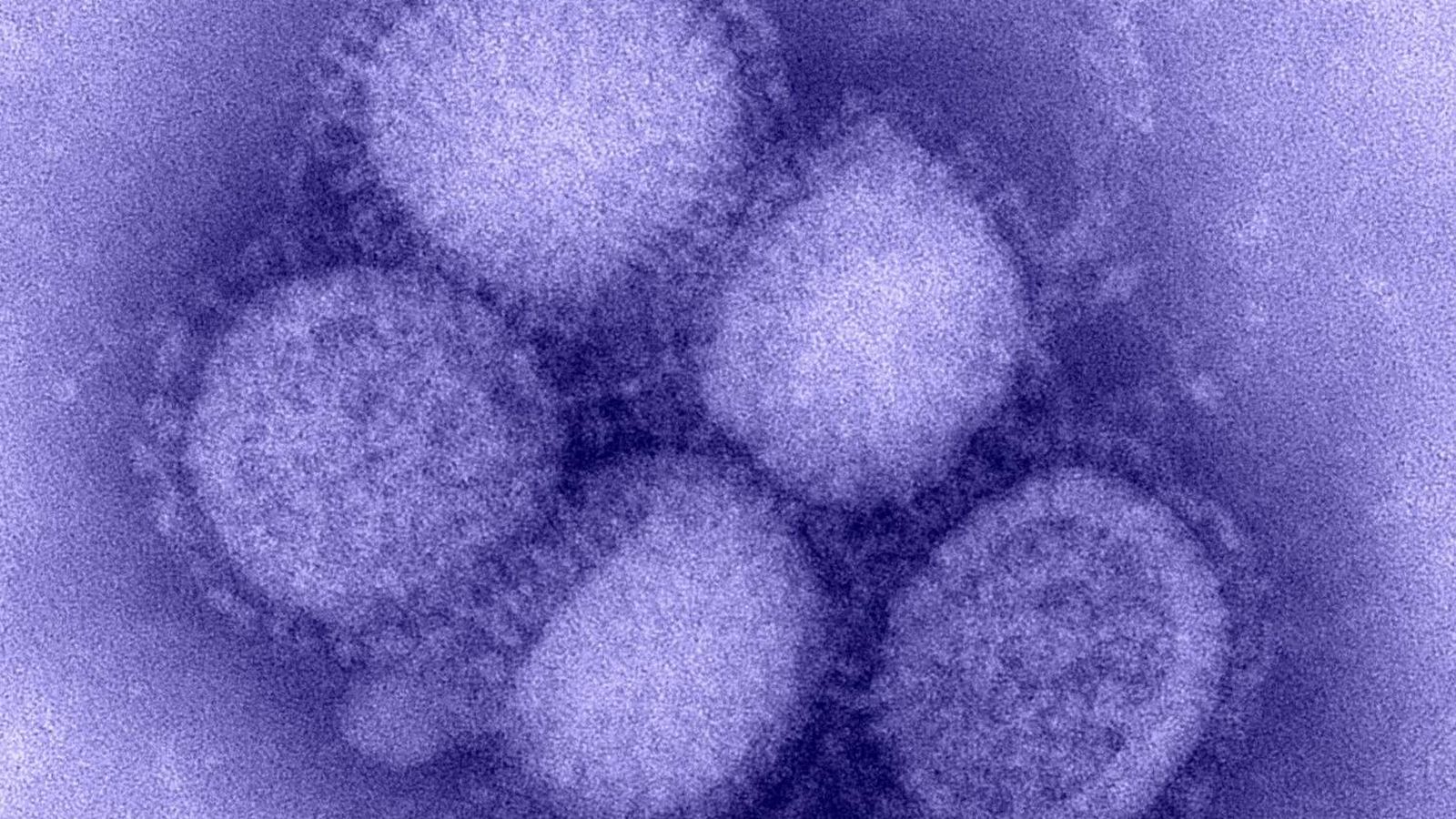 Disparan ultrasonidos contra el virus de la gripe y explota como si fuera de cristal: "Como combatirlo dando gritos"