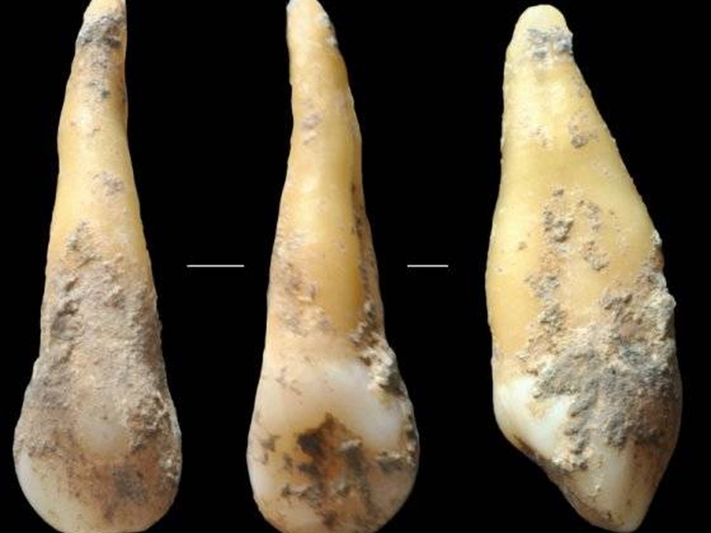 Restos dentales del Neolítico encontrados en Vallirana, Barcelona (Joan Daura y Montserrat Sanz)