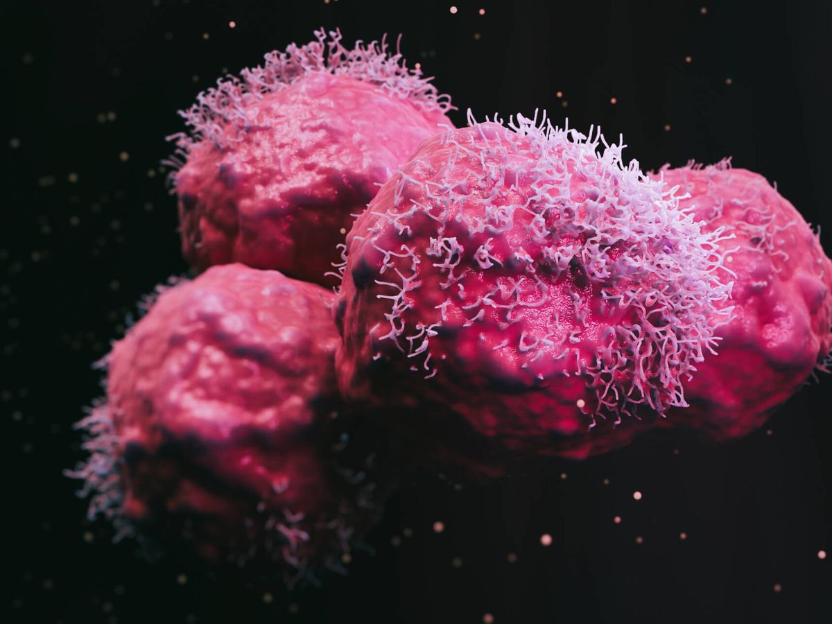 Foto: Recreación 3D de células cancerosas. (iStock)