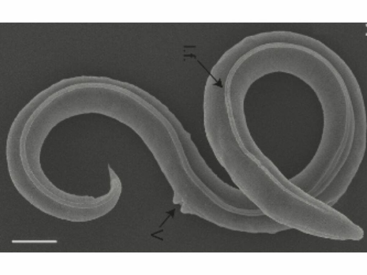 Foto: Un gusano vuelve a la vida 46.000 años después y esto es lo que sucede (Figura A/Alexei V. Tchesunov y Anastasia Shatilovich del Instituto de Problemas Fisicoquímicos y Biológicos en la Ciencia del Suelo)