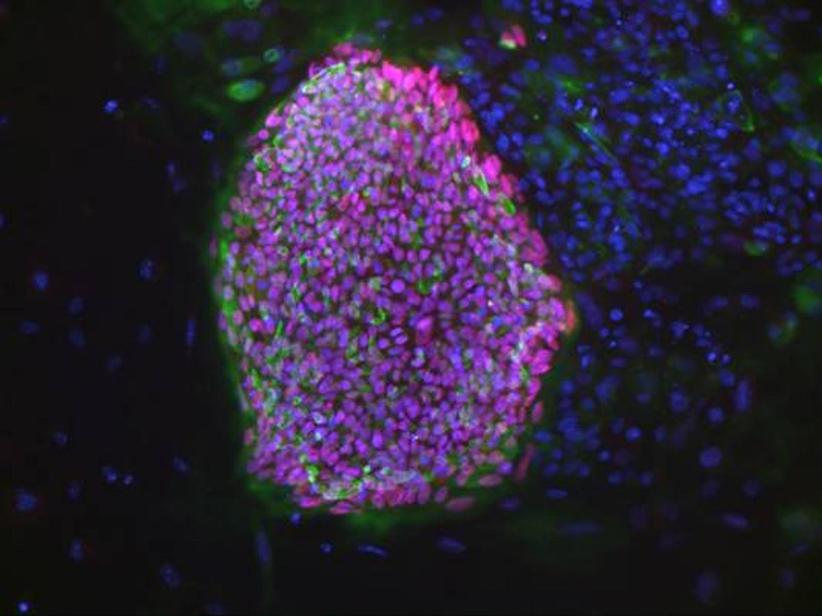 Foto: Una célula beta creada con células madre embrionarias y capaz de producir insulina en diabéticos tipo 1. (Reuters/Bjarki Johannesson)