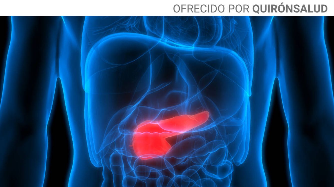 Una investigación española descubre que la vitamina C podría ayudar en el tratamiento del cáncer de páncreas